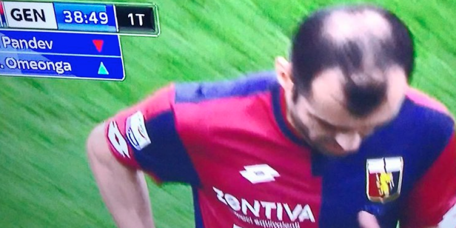 Goran Pandev's bald patch looks like a cock