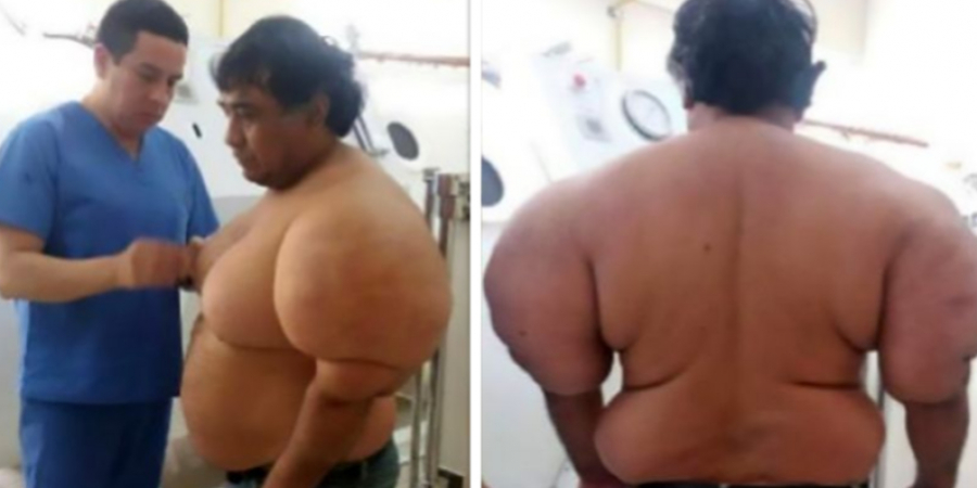 Dude reveals what happened to his body when he got the bends