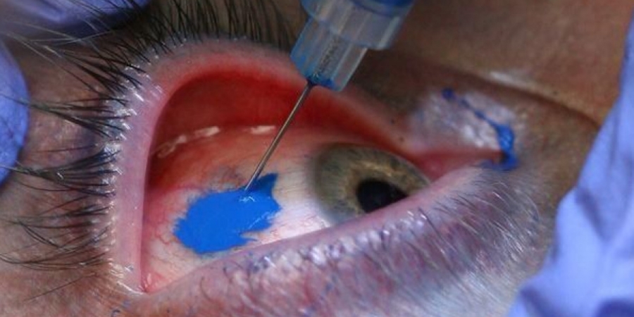 Dude gets his eyeball tattooed & it's bloody revolting
