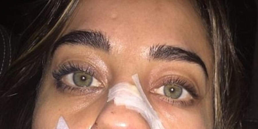 Model cancels huge blowjob tour after being attacked by dog