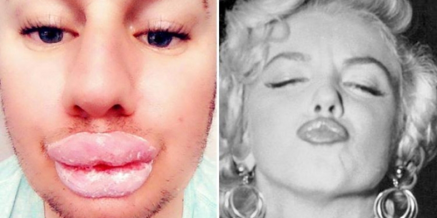 Dude spends a fortune on surgery to look like Marilyn Monroe