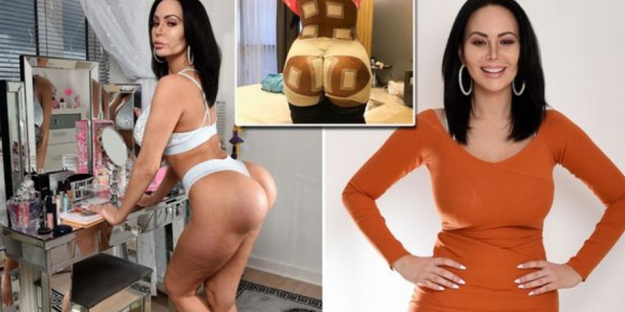 Plastic surgery addict can't sit down after being left with botched bum implants