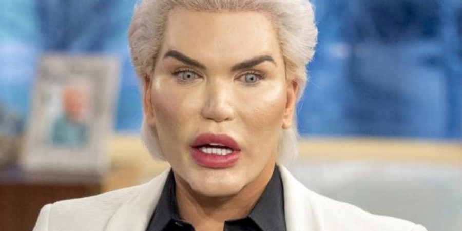 Human Ken Doll Rodrigo Alves reveals his biggest surgical regret