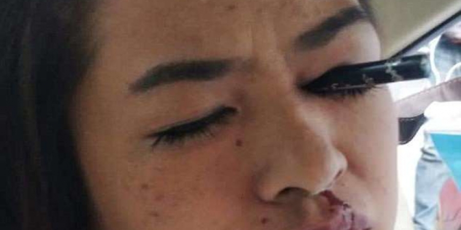 Woman gets eyeliner stuck in her eye after doing her makeup in the car