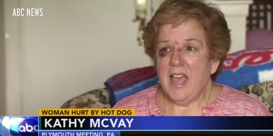 Philadelphia Phillies fan injured after she was hit in the face by flying hotdog