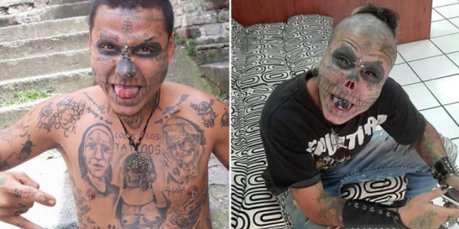 Dude has half his nose removed to achieve his dream of looking like a skull