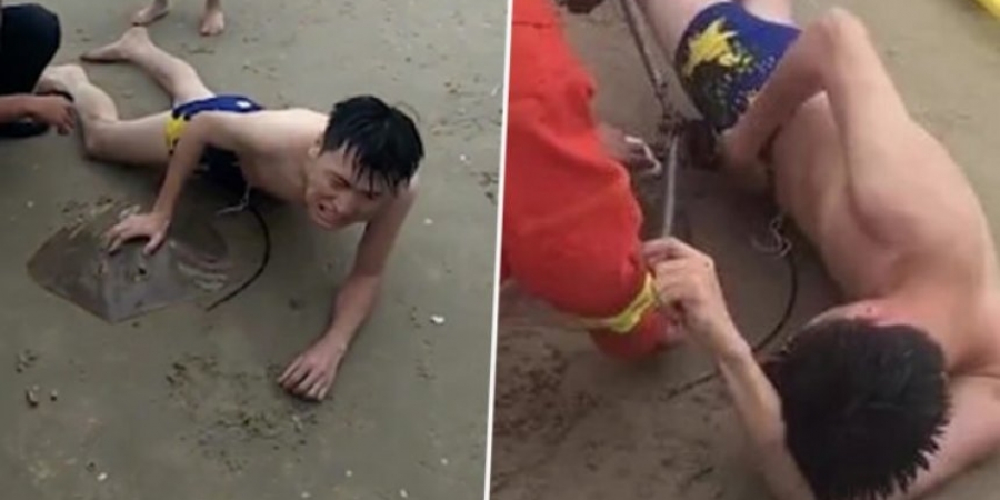 Dude gets stung on the dick by a stingray whilst swimming in the ocean