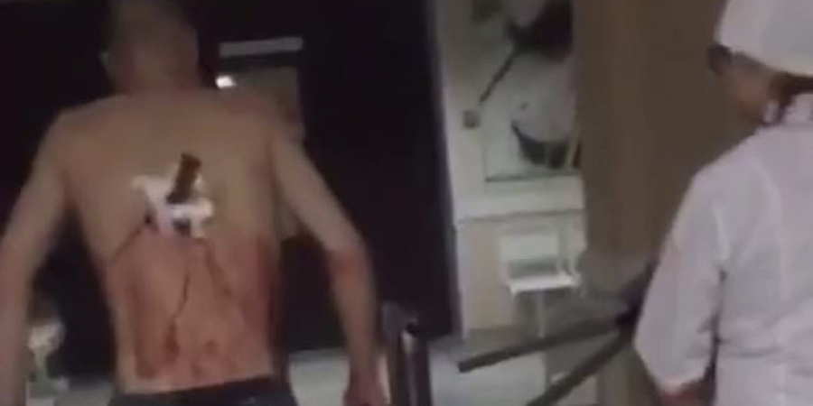 Russian dude with knife in his back pops out for a quick ciggy