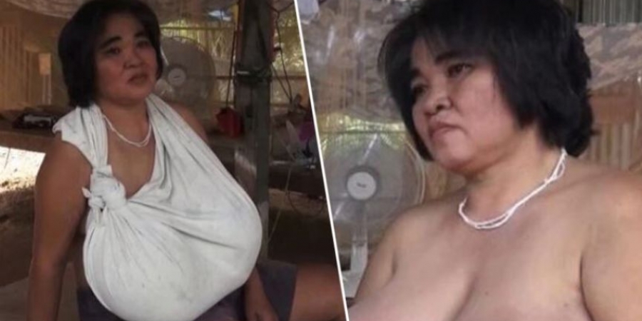 Doctors can't figure out why this woman's boobs won't stop growing