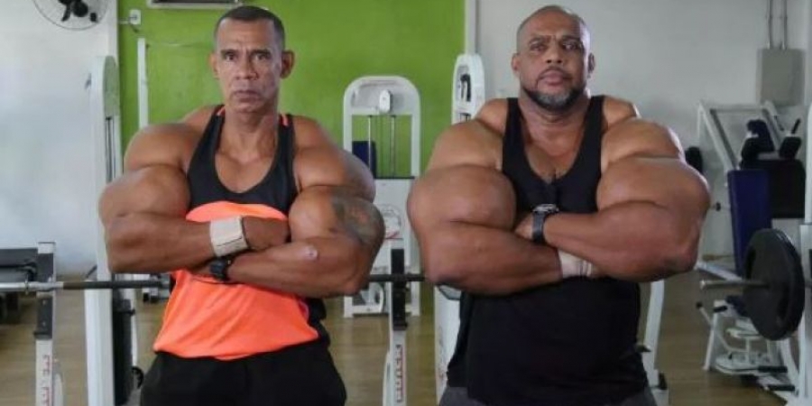 Brothers dubbed 'Hulk' & 'Conan' inject cattle hormone to achieve huge biceps
