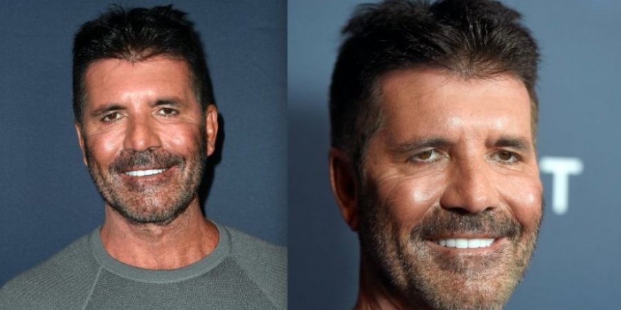 WTF has Simon Cowell done to his face?!!!