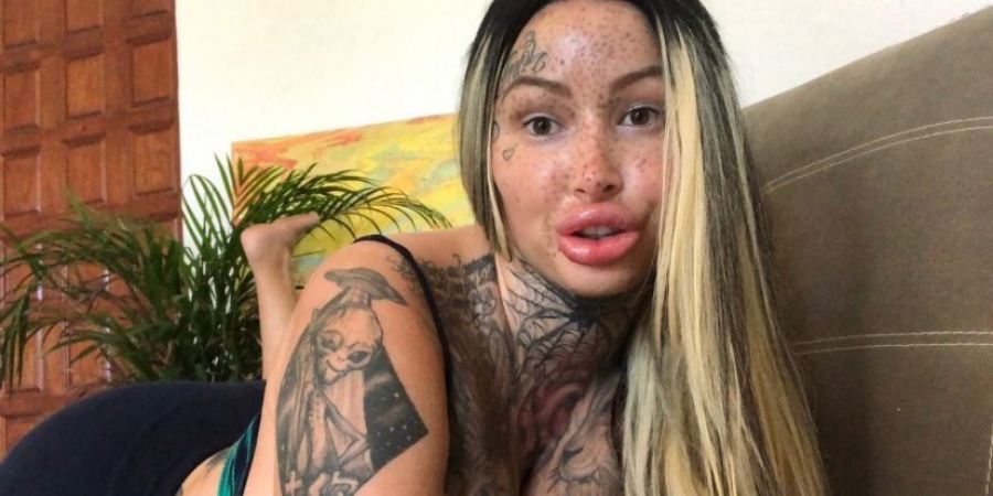 Model undergoes surgery to achieve 'fattest vagina in the world'