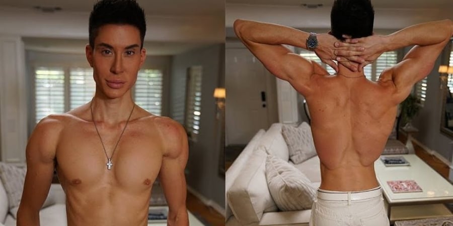 Dude becomes the first in the world to get back implants!