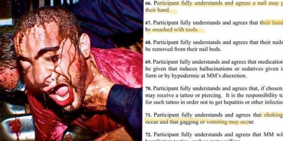 McKamey Manor faces huge backlash after waiver reveals they're allowed to rip your teeth out!