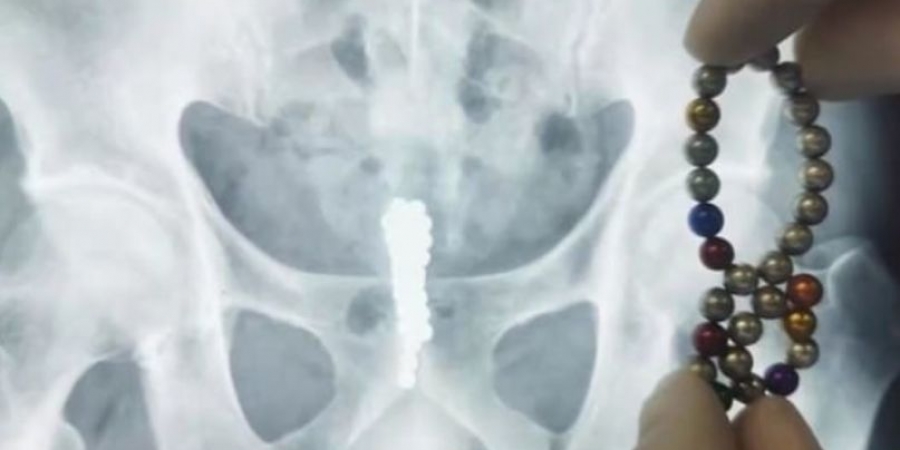 Dude shoves 28 magnetic balls in his cock while sleepwalking