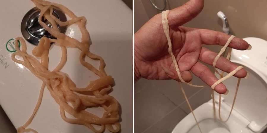Man pulls 32ft LIVE tapeworm from his ass!