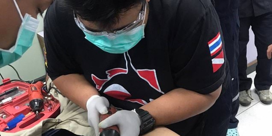 Dudeâ€™s dick starts to rot after he got it stuck in metal pipe for 5 days!