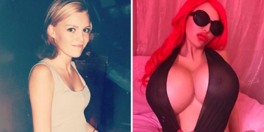 This model has spent Â£200,000 on surgery to look like a Pamela Anderson doll