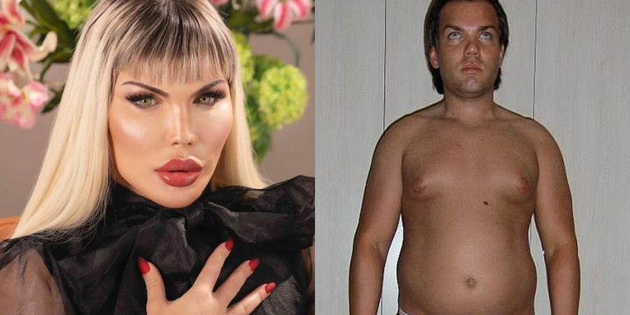 Human Ken Doll undergoes gender reassignment surgery to become Barbie Doll