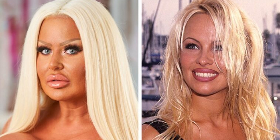 West Sussex woman forks out thousands to look like Pamela Anderson