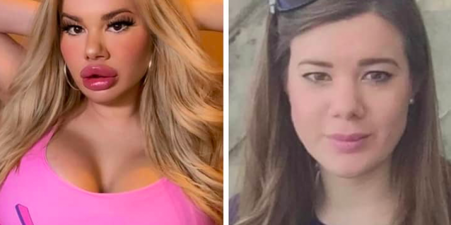 Proud bimbo reveals her posh family’s reaction to her extreme look